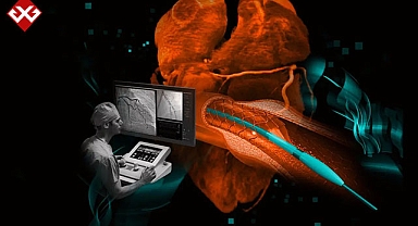 Kalp ameliyatlarında yeni dönem: Robotik kateter
