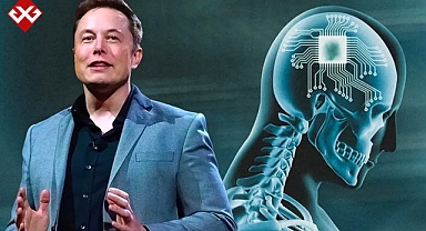 İlk kez bir insana beyin çipi yerleştirdi! Neuralink'ten çığır açan başarı